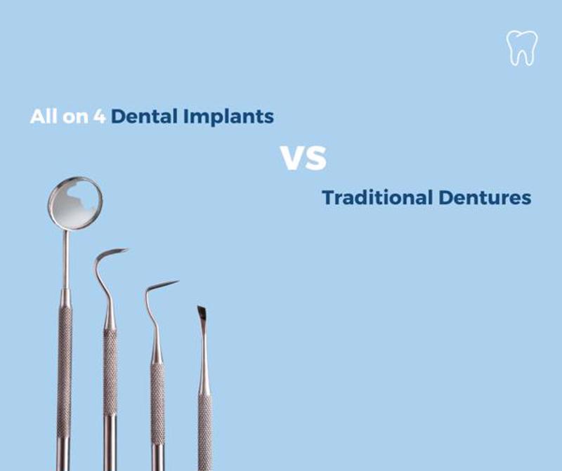 All on 4 Dental Implants vs Traditional Dentures
