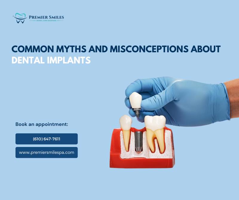 Common myths and misconceptions about Dental implants