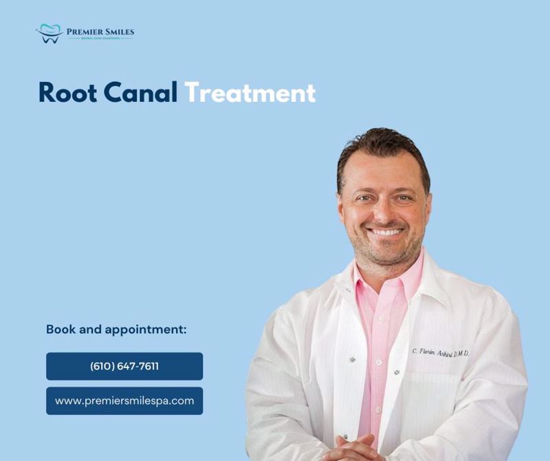 Understanding Root Canal Treatment