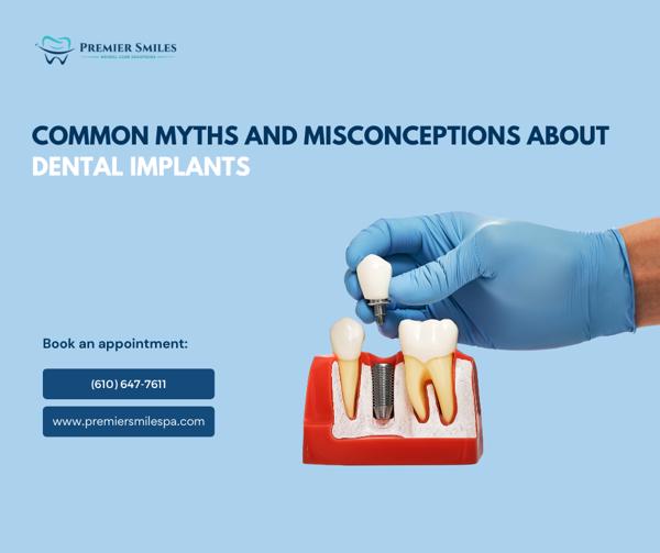 implants myths