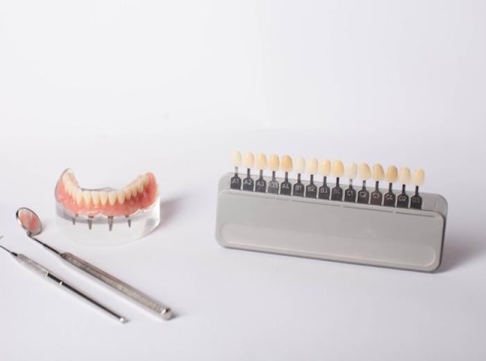 When is All-on-4 Dental Implants the best option for you? 5 things you should know