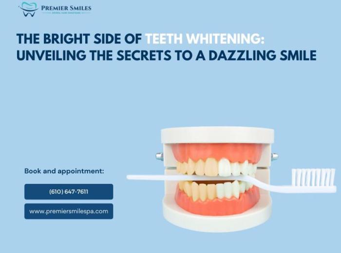 The Bright Side of Teeth Whitening: Unveiling the Secrets to a Dazzling Smile