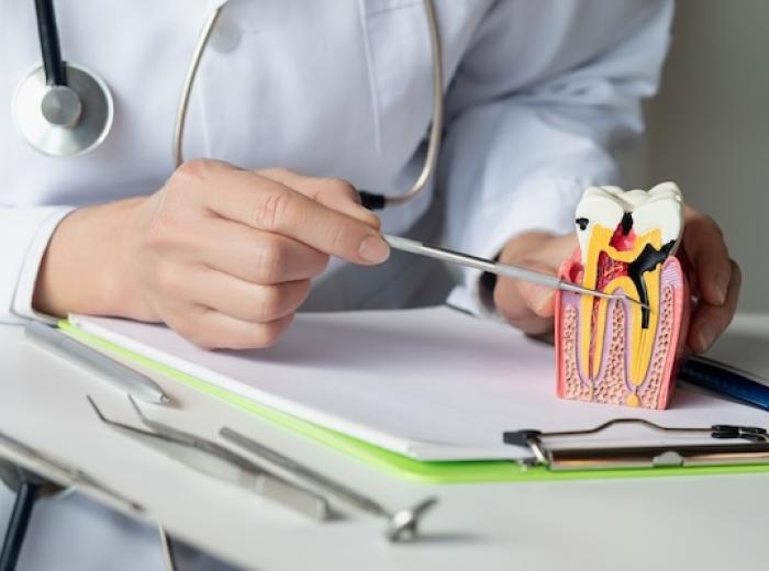 Prefabricated blood vessels may contribute to the improvement of the root canal treatment