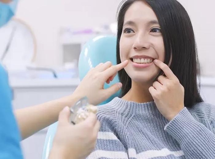 Tooth bonding versus dental crowns. What is best for me?