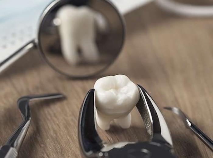 Wondering what a dead tooth is? Let’s find out together.