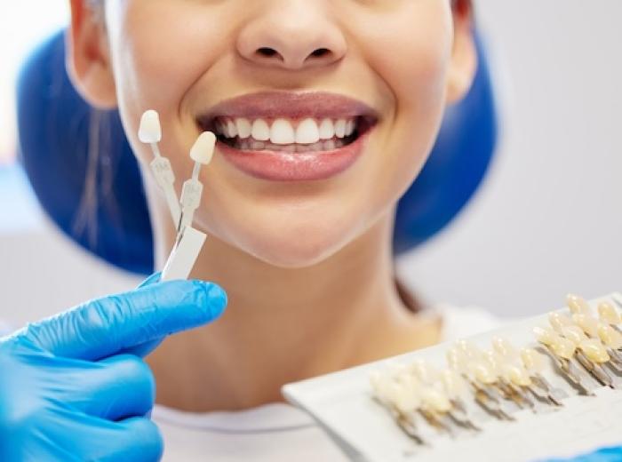 Are veneers a good solution if we want a beautiful smile in a short time? Let’s find out together