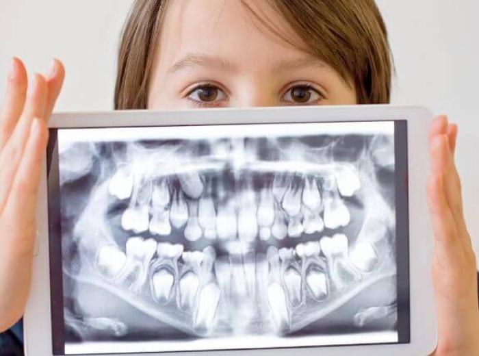 Dental X-Rays: 7 of Your Top Questions, Answered!