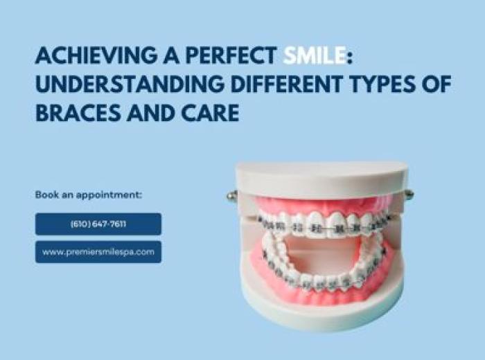 Achieving a Perfect Smile: Understanding Different Types of Braces and Care