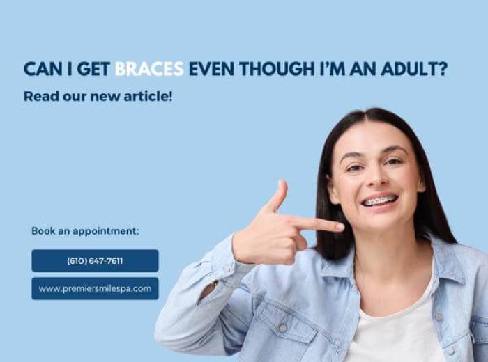 Can I get braces even though I’m an adult?