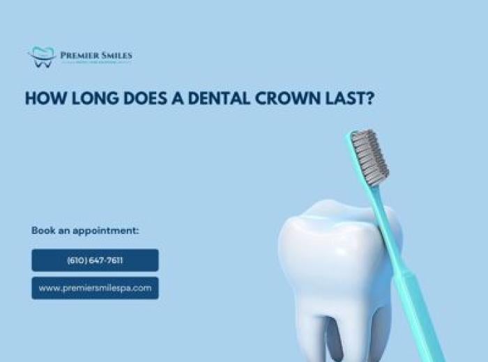 How Long Does a Dental Crown Last