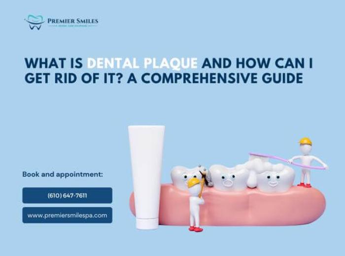 What is Dental Plaque and how can I get rid of it? A Comprehensive Guide