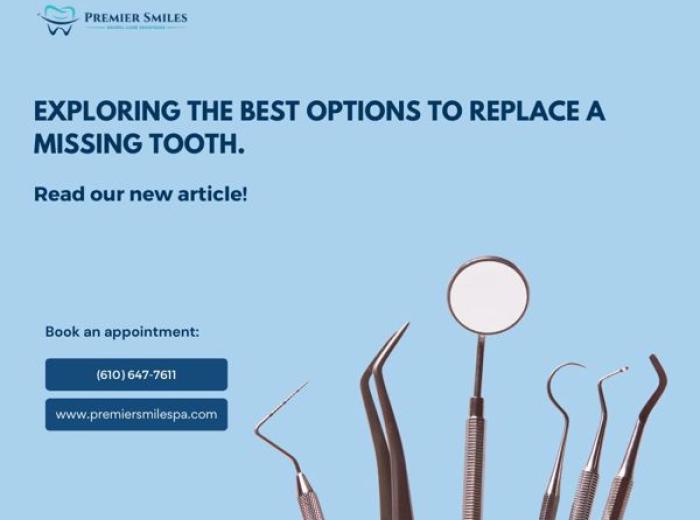 Exploring the best options to replace a missing tooth