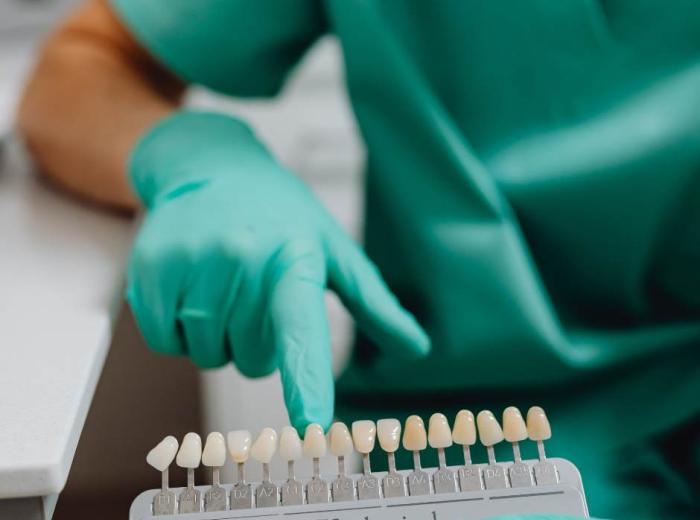 How to Keep Your Porcelain Veneers Looking Beautiful for Years: Expert Tips from Premier Smiles