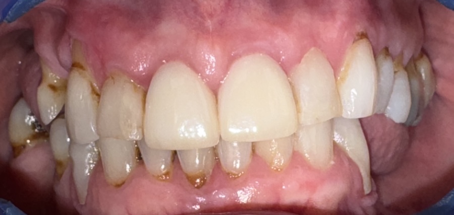 case-1-before_