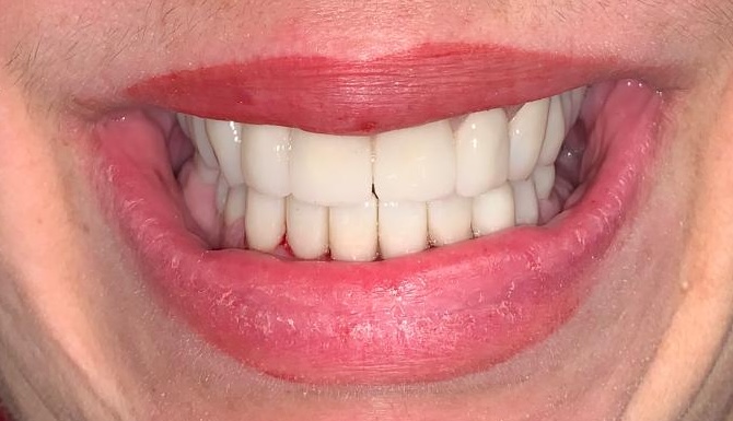 case-2-after